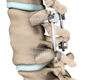 Spine - Educational Picture