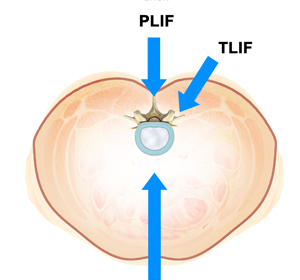 Spine - Educational Picture