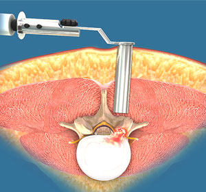 Spine - Educational Picture