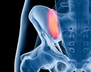 Sacroiliac Joint - Educational Picture