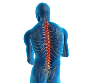 Spine Injuries in Athletes - Educational Picture