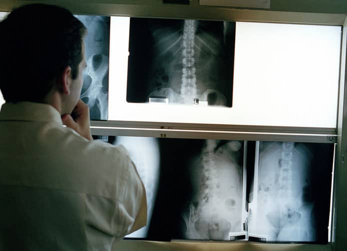 customizable is a spinal cord stimulator