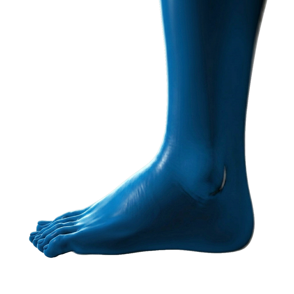 Ankle swelling