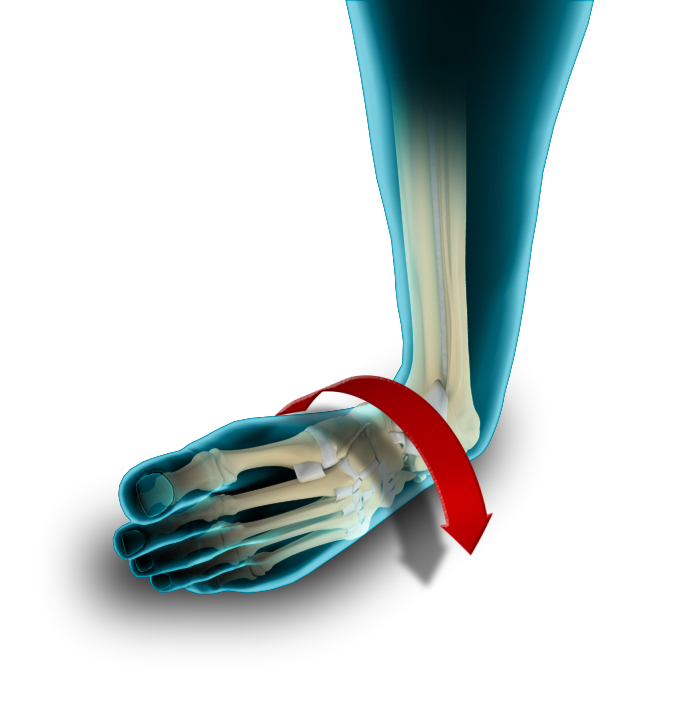 Chronic ankle instability