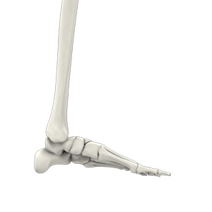 Flatfoot