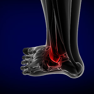 Foot and Ankle Trauma