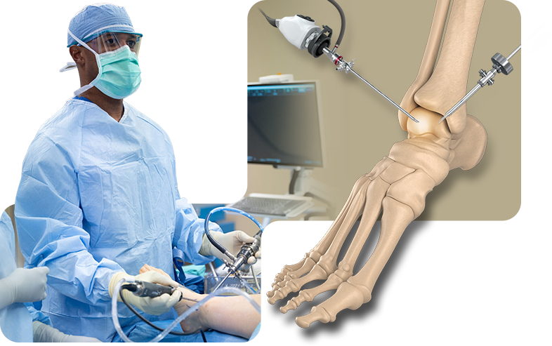 Ankle Arthroscopy