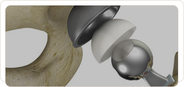 Publications Acetabular Img