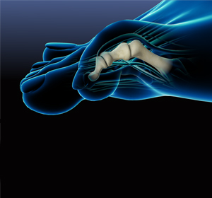 Foot Deformities - Educational Picture