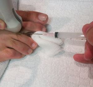 Ultrasound Guided Injections - Educational Picture
