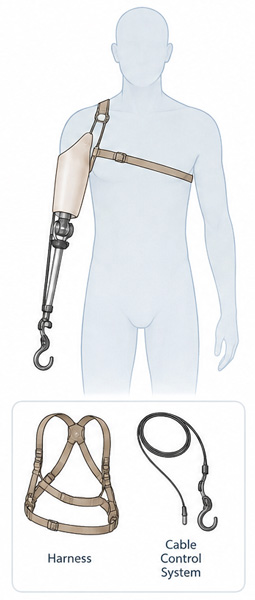 Body-Powered Systems - Picture