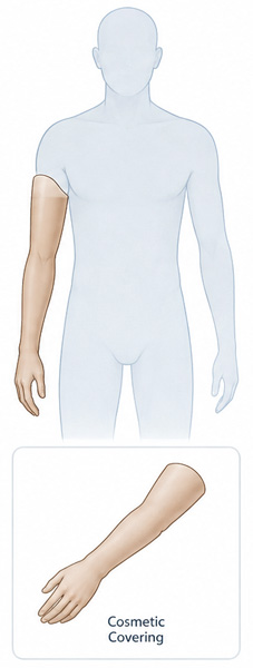 Cosmetic Prosthesis - Picture