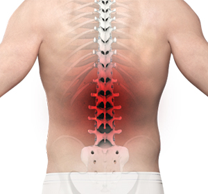 Back Pain Image