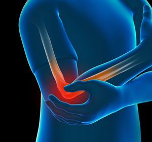 Elbow Injuries Image