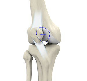 Fractures & Dislocations Image