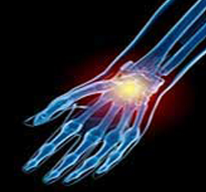 Wrist Injuries Image