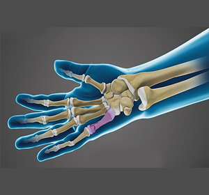 Hand Injuries and Conditions Image