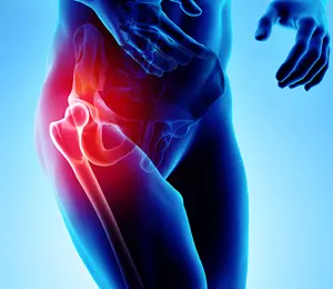 Hip Pain Image