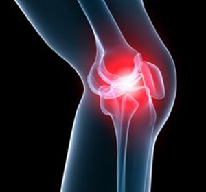 Knee Pain Image