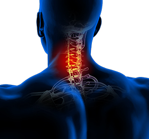 Neck Pain Image