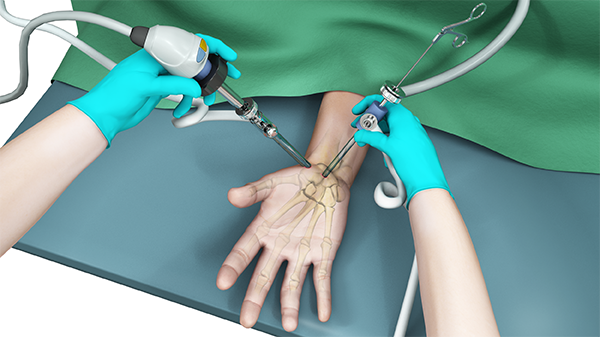 Elective/Emergency Hand Surgery