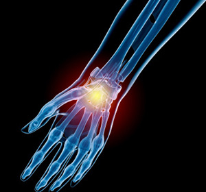 Hand and Wrist Sports Injuries