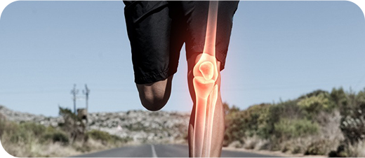 Joint Replacement and Reconstruction