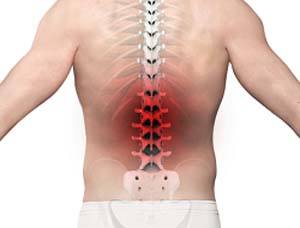 Back Pain pic