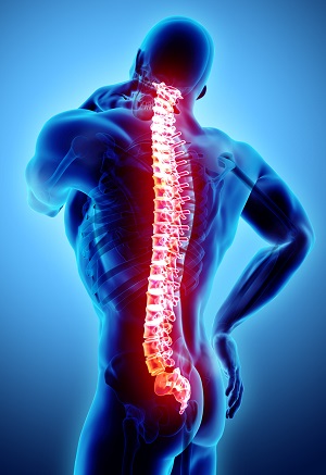 Neck and Back Injuries pic