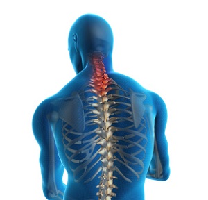 Neck Strains and Sprains pic