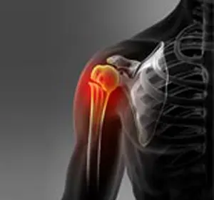 Fracture Care - Educational Picture