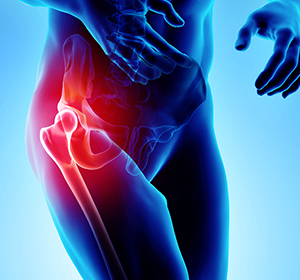 Hip Pain - Educational Picture