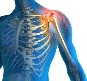 Shoulder Pain - Educational Picture