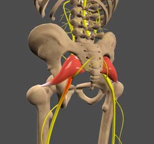 Sciatica pic