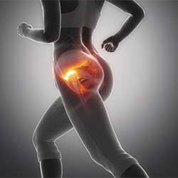 Picture of Hip Injuries