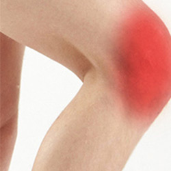 Picture of Knee Pain