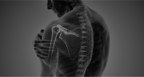 Picture of Shoulder