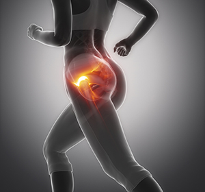 Acute Hip Pain