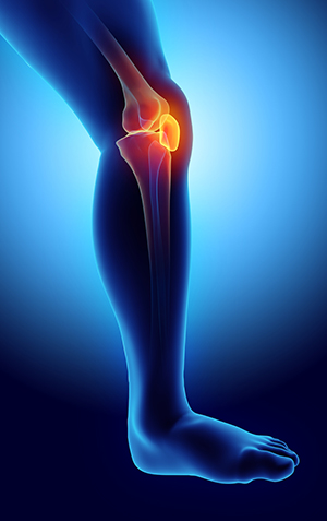 Sudden Knee Pain