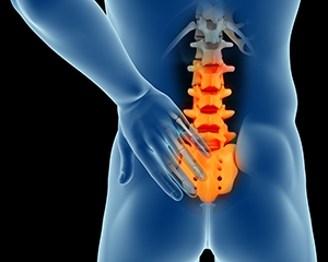 Sudden Low Back Pain