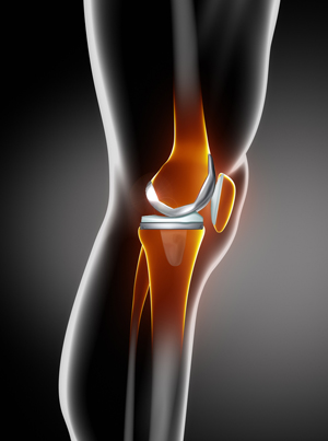 Knee Conditions picture