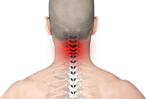 Neck Pain picture
