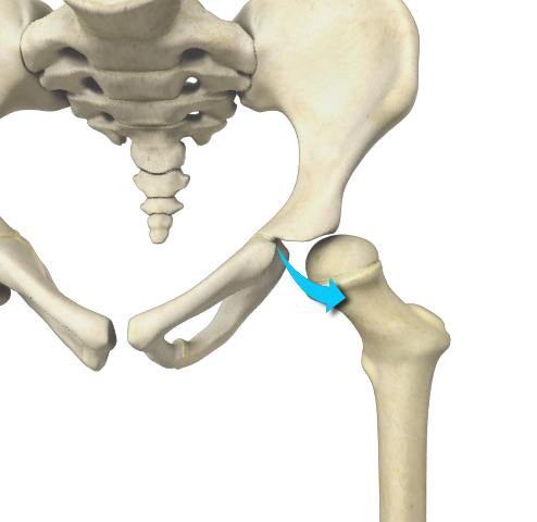 Developmental Dysplasia - Educational Picture