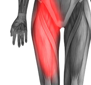 Hip Flexor Pain - Educational Picture