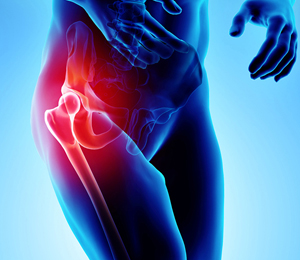 Hip Pain Treatment - Educational Picture