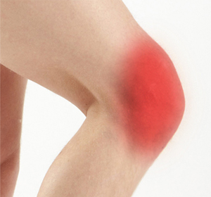 Knee Pain Treatment - Educational Picture