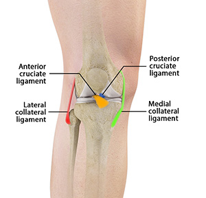 Multiligament Knee Injuries - Educational Picture