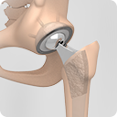 Anterior Picture