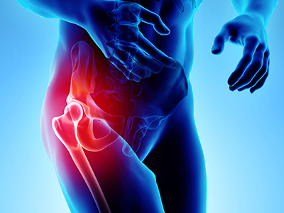 Hip Pain - Educational Picture