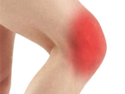 Knee Pain - Educational Picture